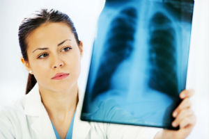 doctor holding lung x-ray